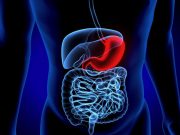 Revisional-RYGB Examined for GERD and Weight-Loss Failure