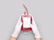 One in Four Patients in ICU Receive Red Blood Cell Transfusion