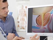 Minimally Invasive Transperineal Laser Ablation of the Prostate Appears Effective