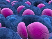 IVIg Reduces Infection Rate in Multiple Myeloma Patients Receiving Anti-BCMA Therapy