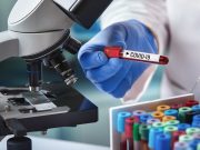 In-Hospital Mortality Evaluated for SARS-CoV-2-Linked Sepsis