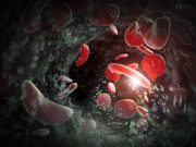 First Gene-Editing Therapies for Sickle Cell Disease Approved by FDA