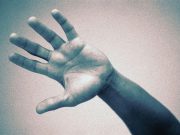 Patients Report Positive Outcomes for Nonsurgical Treatment of Thumb OA