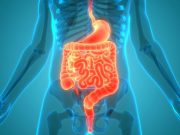 Beans Beneficial for Patients With History of Colorectal Neoplasia