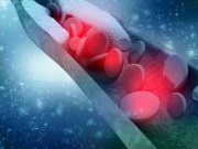 High Levels of HDL Cholesterol Tied to Higher Dementia Risk