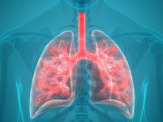 10-Year Lung Cancer-Specific Survival for Low-Dose CT Persists
