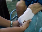 Pain Reduced With Target Muscle Reinnervation at Time of Amputation