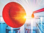 Gene Therapy for Sickle Cell Disease Likely Cost-Effective at