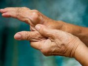 Ten Variants Suggest Link to Surgical, Nonsurgical Rhizarthrosis