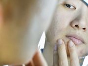 2004 to 2019 Saw Increase in Isotretinoin Use in Girls, Women