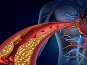 Coronary Artery Disease Testing After Initial Heart Failure Hospitalization Aids Outcomes
