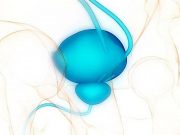 Risk for Benign Prostatic Hyperplasia Increased for Patients With Gout