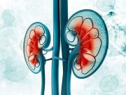 Pembrolizumab Shows Survival Benefit for Patients With Renal Cancer