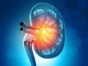 Living Kidney Donors Have Lower Rates of Fractures Overall