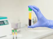 Sex-Specific Detection Panels Show High Accuracy for Early-Stage Cancer