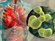 Guidelines Developed for Diagnosis, Management of Cryptococcosis