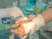 Study Looks at Access to U.S. Burn Centers Using 2019 Data