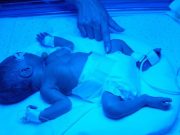 Opioid Exposure Linked to Increased Odds of Preterm Birth