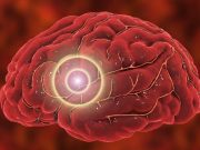 Brain Cancer Risk Increased After Moderate/Severe, Penetrating TBI