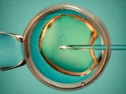 Intracytoplasmic Sperm Injection Does Not Help Increase Live Births