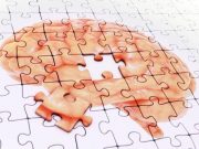 Timing of CSF Biomarker Divergence for Alzheimer Disease, Normal Cognition Varies