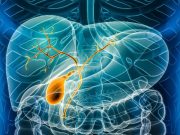 Seladelpar Beneficial for Patients With Primary Biliary Cholangitis