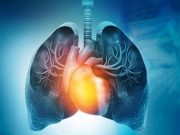 Ready-to-Eat Food Environment Linked to Risk for Heart Failure