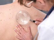 Gender Minority Adults Are Vulnerable During Full Body Skin Exam