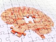 Healthier Lifestyle Linked to Better Global Cognition Close to Death