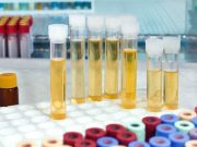 Clinician Decision Support Can Reduce Unspecified Testing in Primary Care