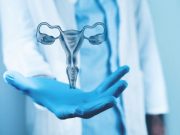 Simple Hysterectomy Not Inferior for Pelvic Recurrence in Cervical Cancer