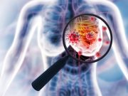 Tailored Axillary Treatment Safely Avoids Lymph Node Removal in Breast Cancer