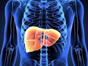 GLP-1 RA Reduces Severity of Steatotic Liver Disease in People With HIV