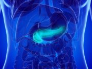 Evidence-Based Approach Recommended for Acute Pancreatitis Management