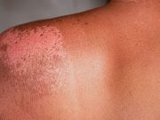 Survey Assesses Perspectives on Patient Image Use in Dermatology