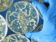 Fewer Cases of Fungal Diseases Coincided With Start of COVID-19