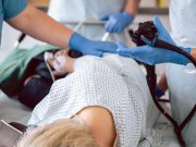 Additional Benefit Seen for Colonoscopy Versus Sigmoidoscopy