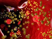 2015 to 2021 Saw Marked Rise in PCSK9 Inhibitor Utilization