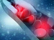 Risk for MI, Stroke, Death Increased With Plastics in Carotid Plaques