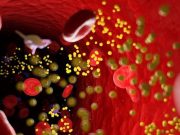 Dyslipidemia Raising Risk for CVD Among Young American Indians