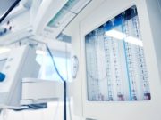 Hyperangulated Video Laryngoscopy Beneficial for Achieving Intubation