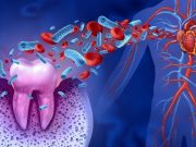 Periodontitis May Modify Risk for Atrial Fibrillation