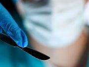 Mortality Down for Rectal Cancer Surgery at NAPRC-Accredited Hospitals