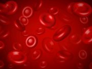 Review Explores Cutaneous Manifestations of Myelodysplastic Syndrome