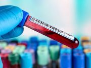 Serum Biomarkers Predict Knee OA Before Radiographic Abnormalities