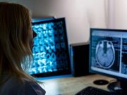 GPT IDs Errors in Reports With Same Accuracy as Radiologists
