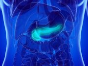 No-Drain Policy Noninferior for Major Morbidity in Distal Pancreatectomy