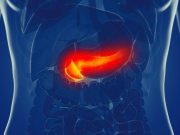 AACR: Exosome-Based miRNA Assay Can Detect Pancreatic Cancer