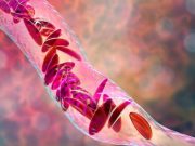 Crude Sickle Cell Birth Prevalence 28.54 per 10,000 in Non-Hispanic Blacks