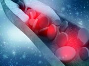 Etidronate Beneficial for Arterial Calcification Due to CD73 Deficiency